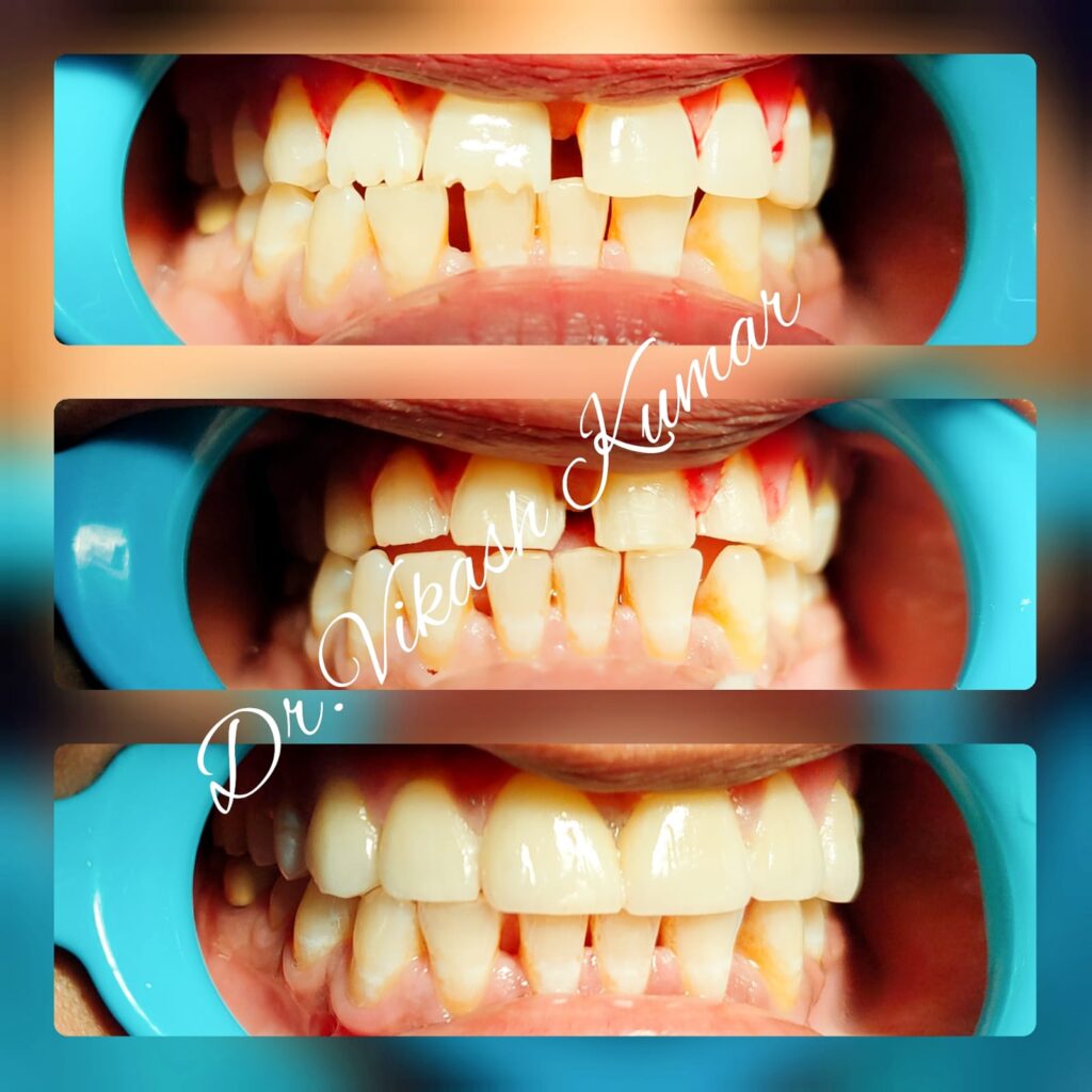 Dental Treatment11
