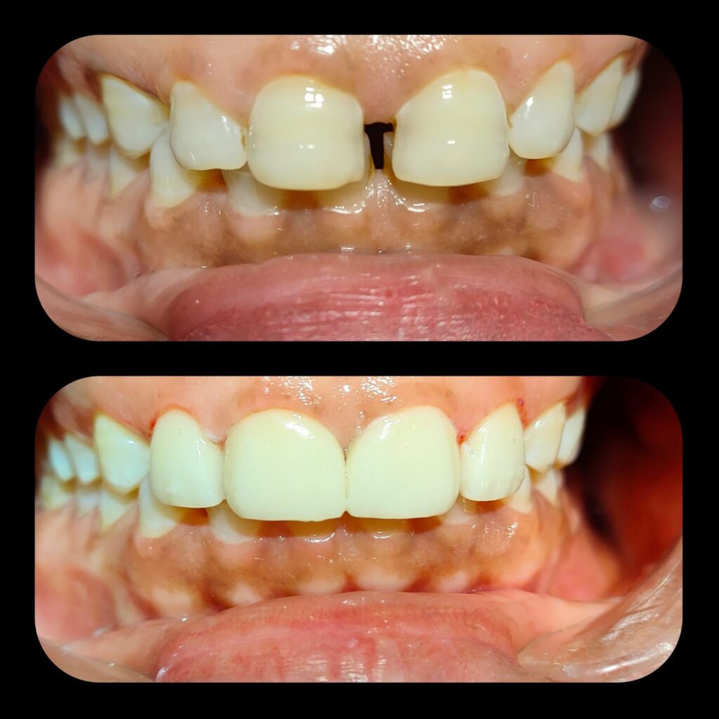 Dental Treatment126