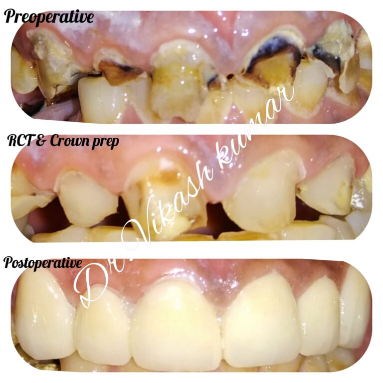 Dental Treatment14