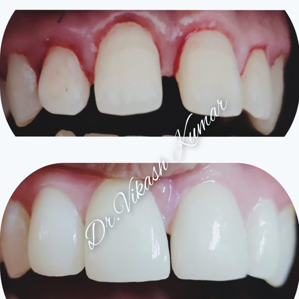 Dental Treatment15