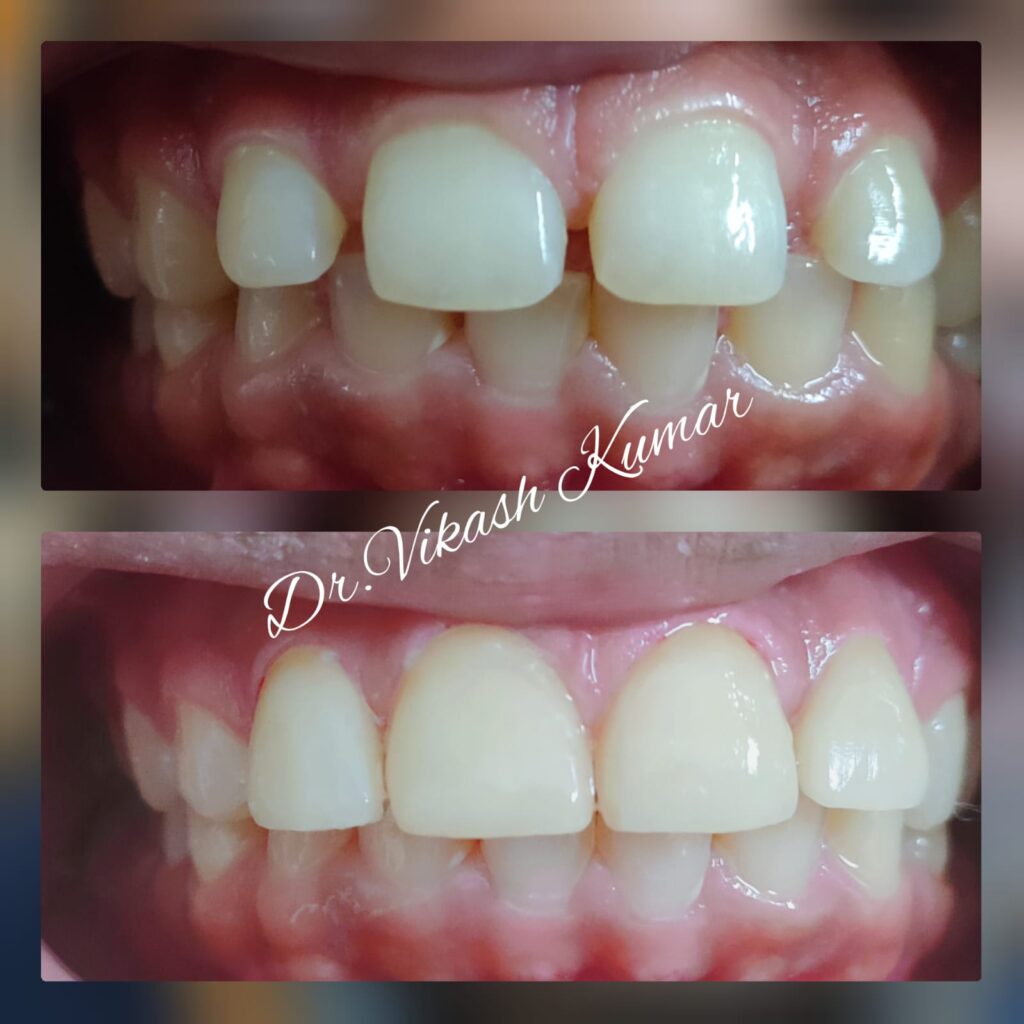 Dental Treatment19