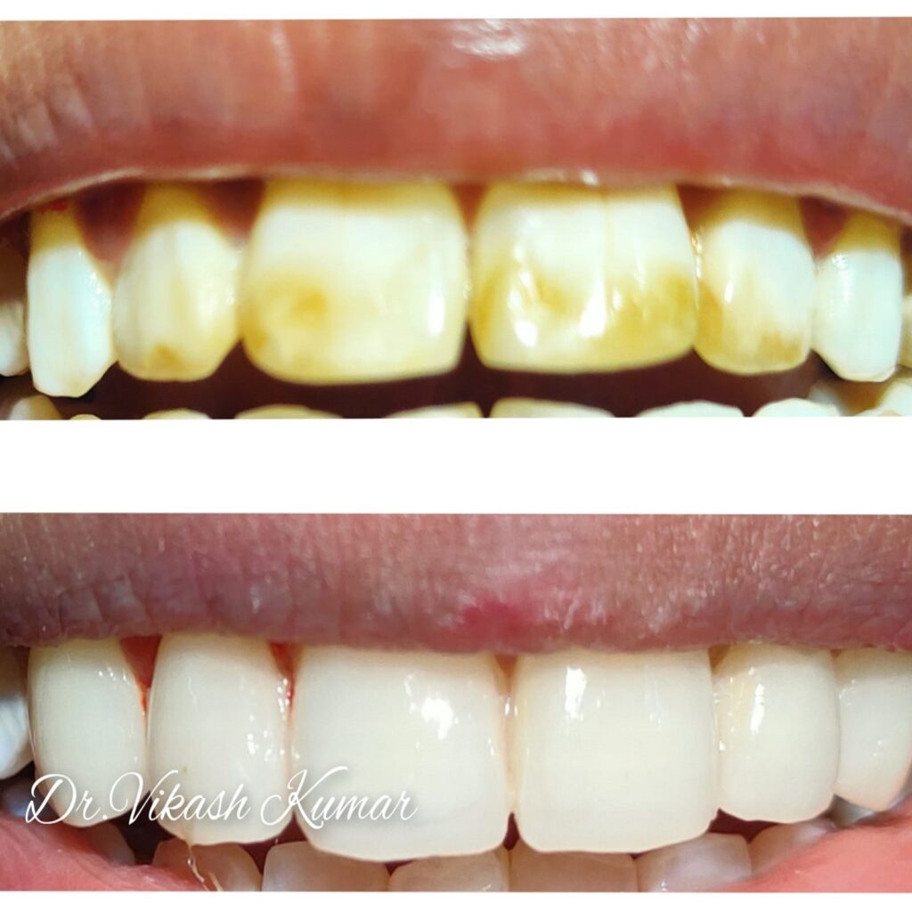 Dental Treatment3