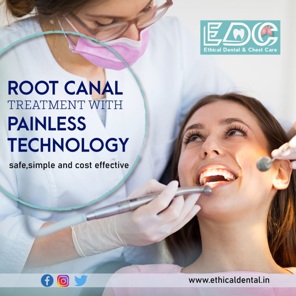 Interesting Facts About the Root Canal Treatment