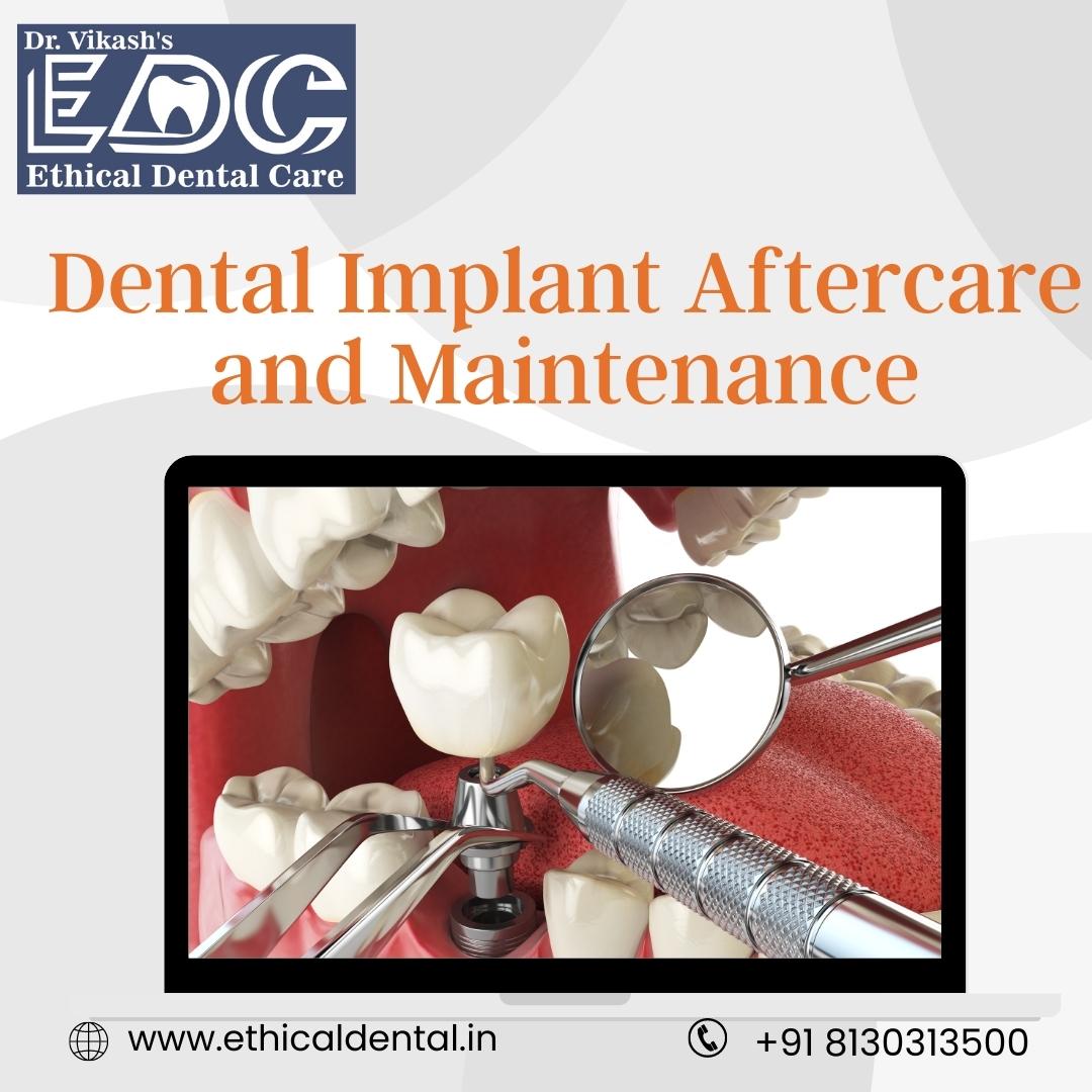 Dental Implant Aftercare and Maintenance: Protect Your New Smile