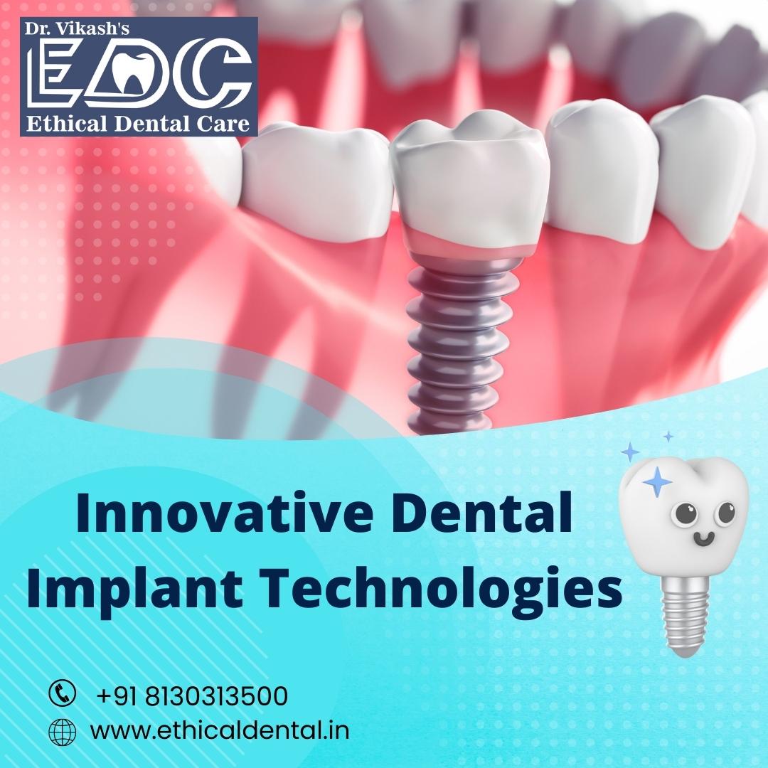 Innovative Dental Implant Technologies