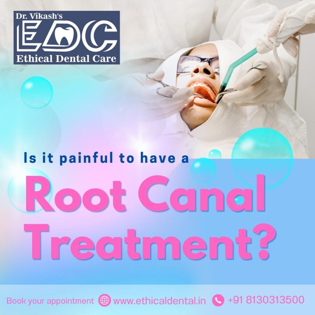 Is It Painful to Have a Root Canal Treatment?