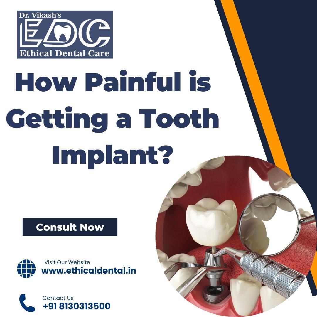 How Painful is Getting a Tooth Implant?