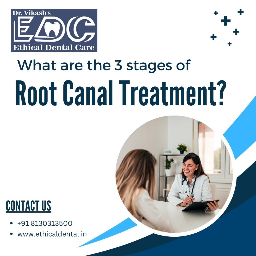 What are the Three Stages of Root Canal Treatment?
