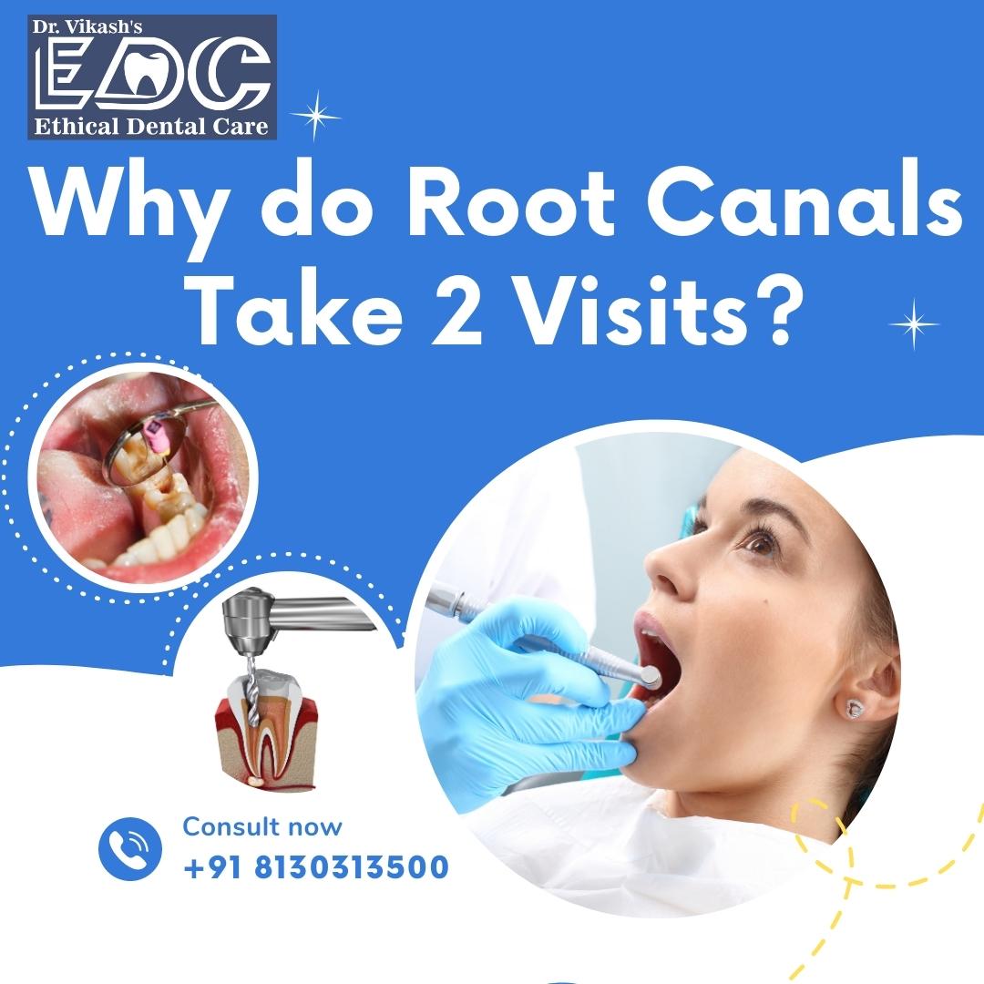 Why do Root Canals Take Two visits?