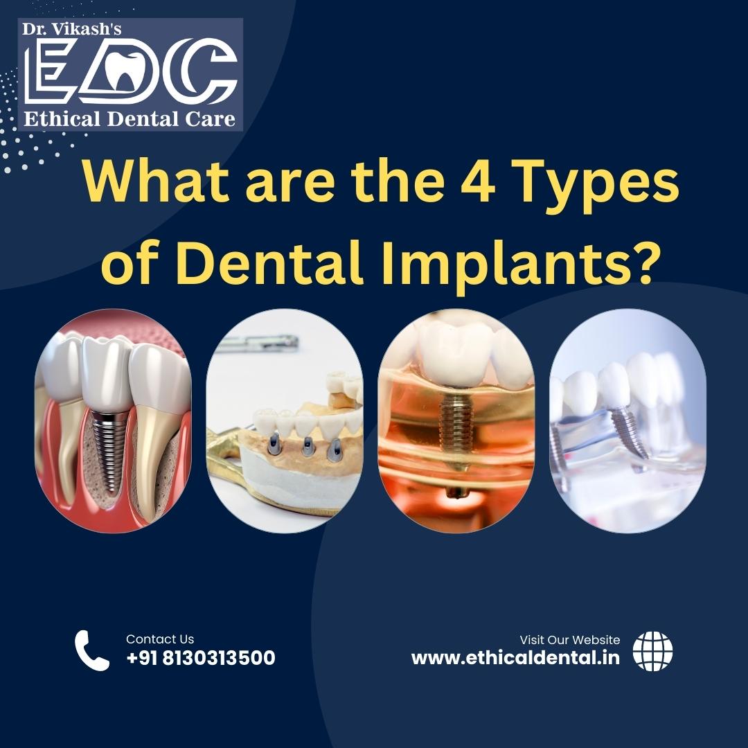 What are the Four Types of Dental Implants?