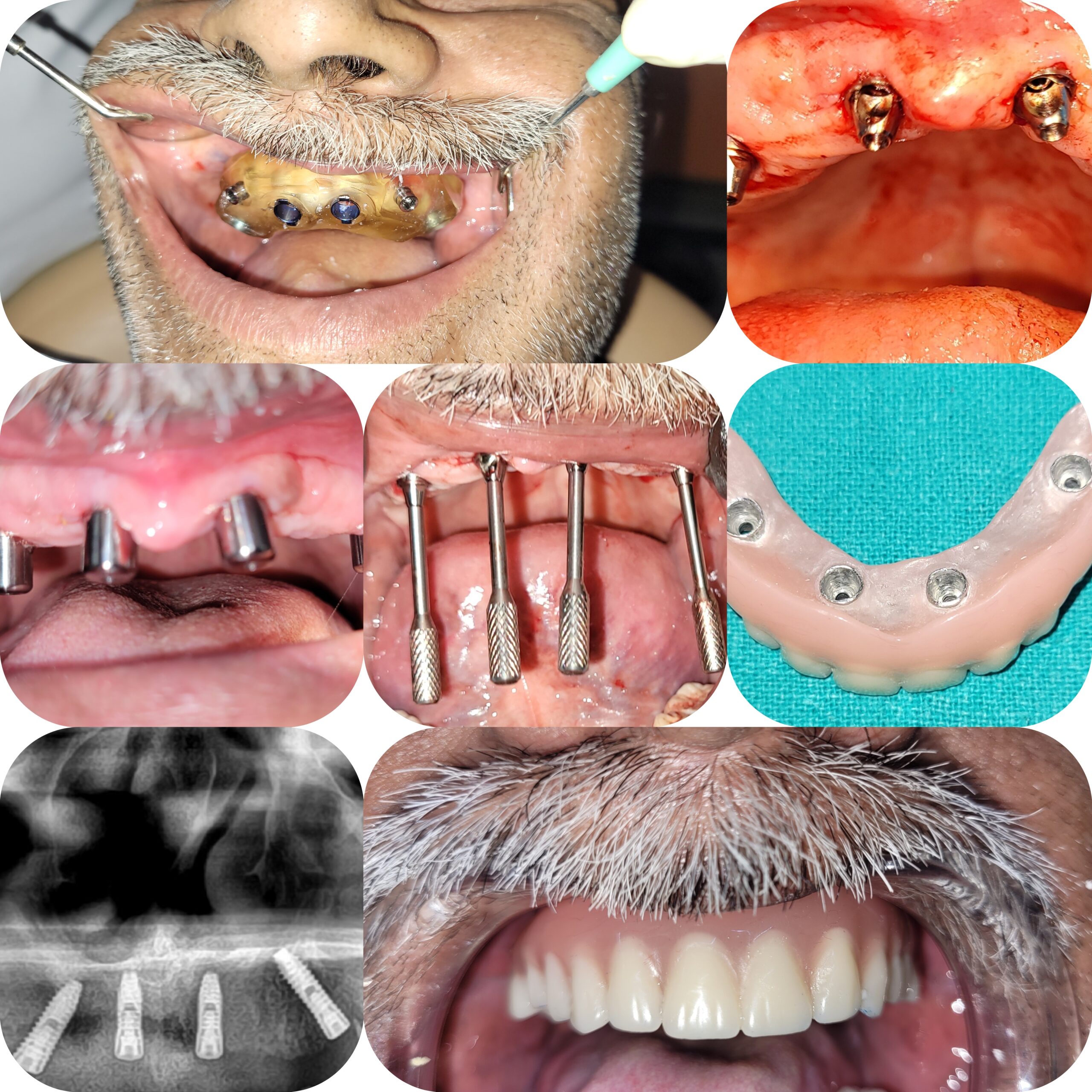 InCollage_20240227_160432110-