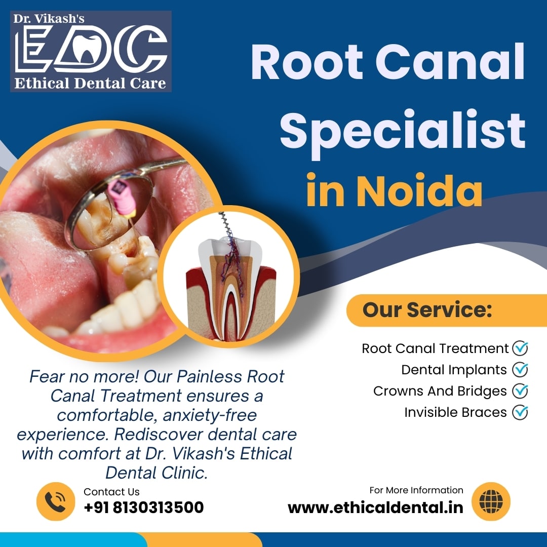 Best Root Canal Specialist in Noida | Dr. Vikash Kumar