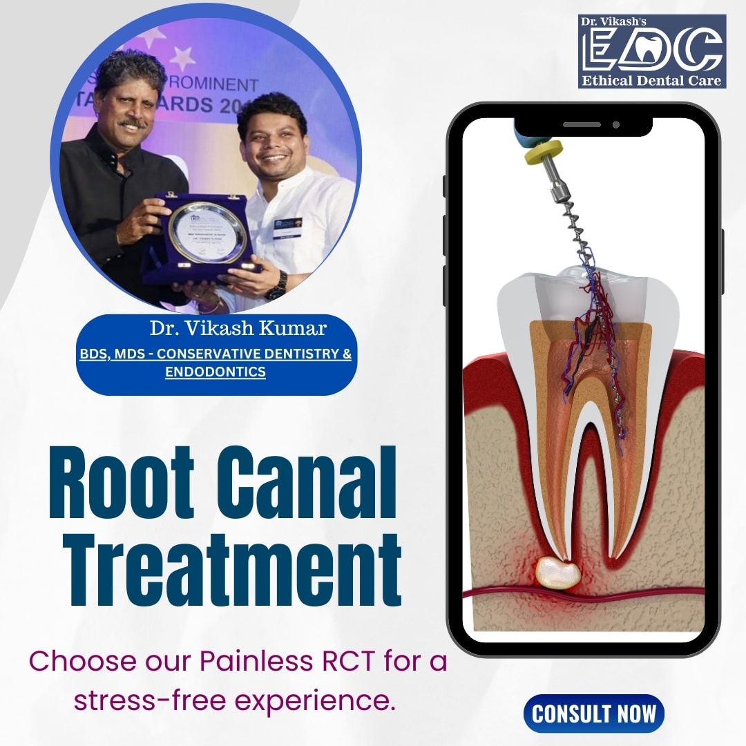 Meet Root Canal Specialist in Noida at Dr. Vikash’s Ethical Dental Care